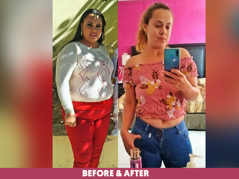 Carla-Before-After-Bariatric-Gastric-Sleeve.png