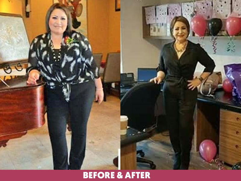Christina-Before-After-Bariatric-Gastric-Sleeve.png